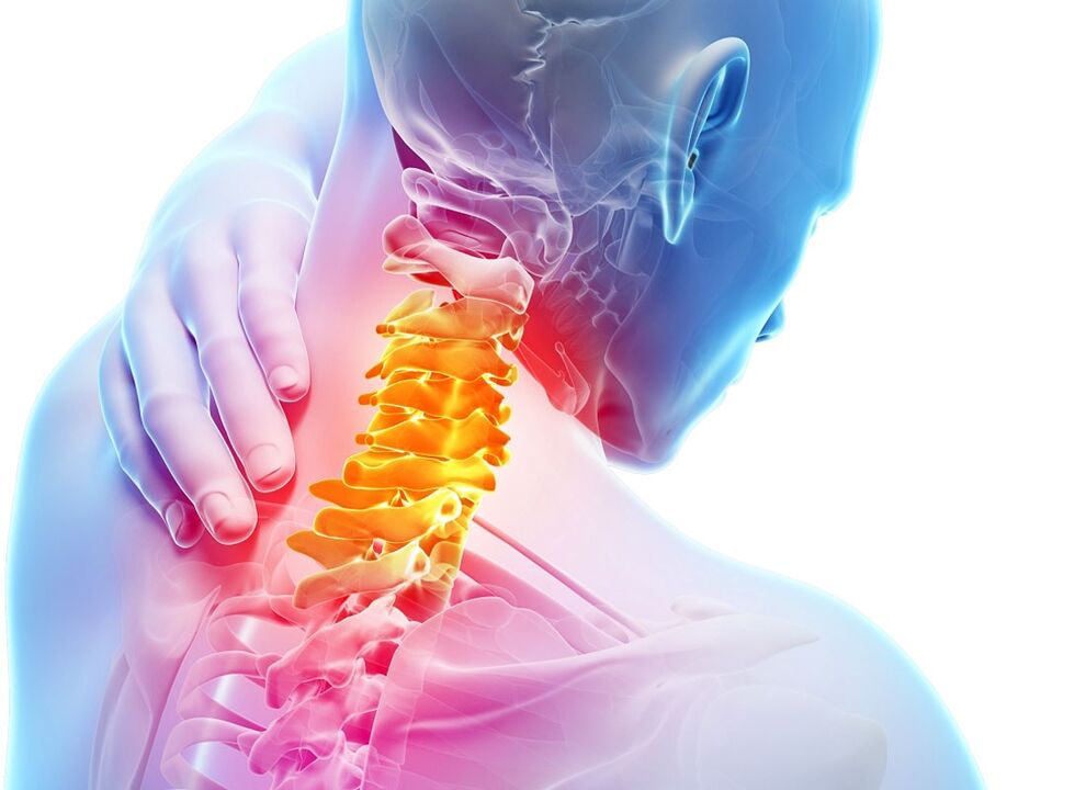 simptomi cervikalne osteohondroze